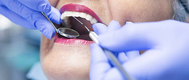 Best Emergency Tooth Extraction in Braham, MN